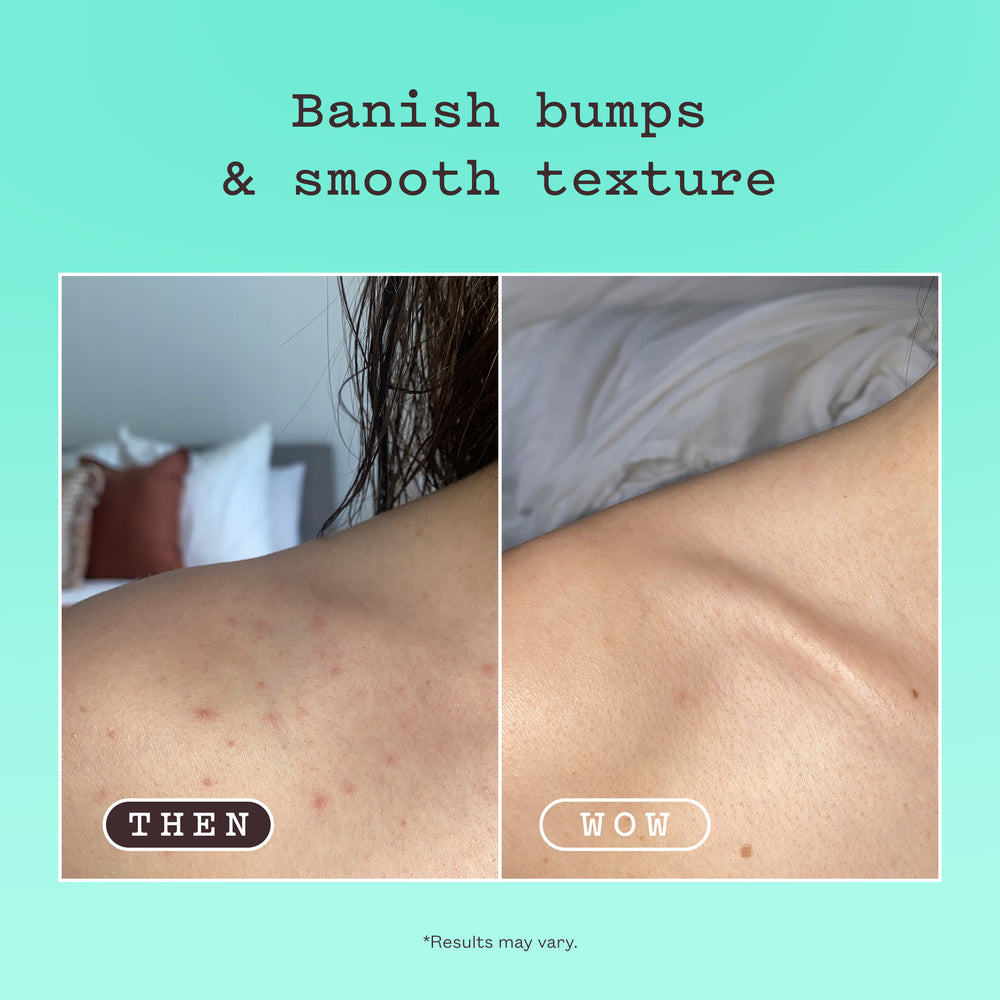 Frank Body Glycolic Body Scrub 250 g — 6