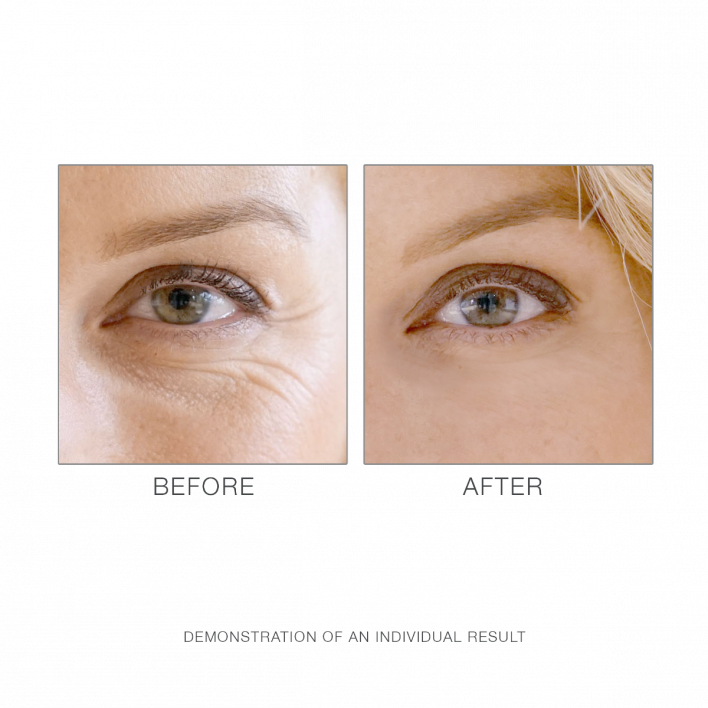 M. Asam Retinol Intense Eye Balm 15ml — 2