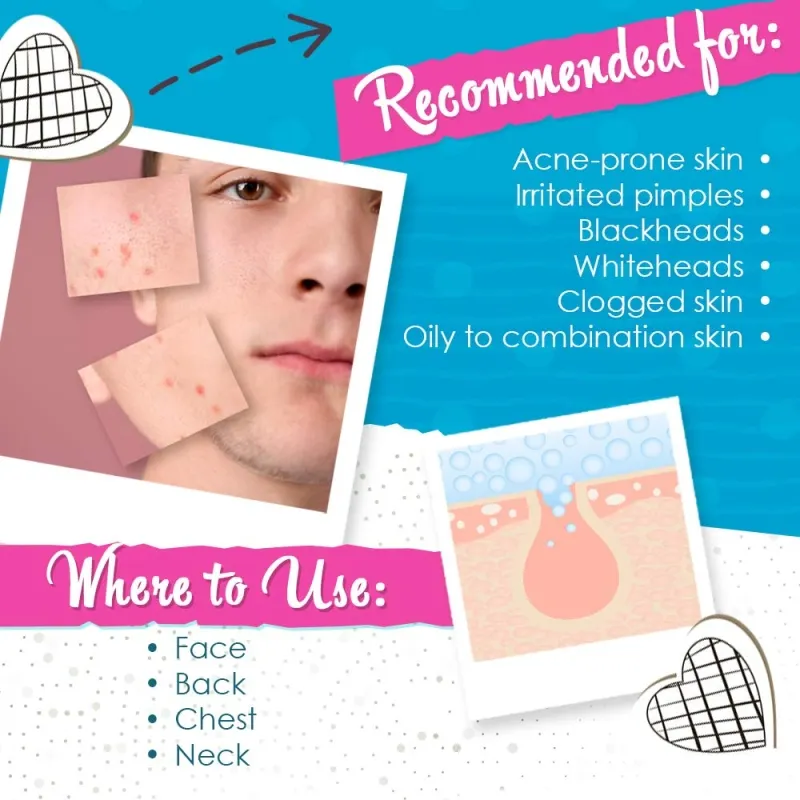 Лосион за локално изсушаване на пъпки Bye Bye Blemish Drying Lotion 29.5ml — снимка 5