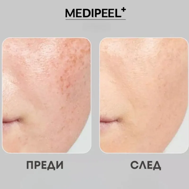 Озаряващ витаминен серум с 20% ниацинамид MEDI-PEEL Peptide 9 Vitanol Ampoule PRO 30 ml — 4