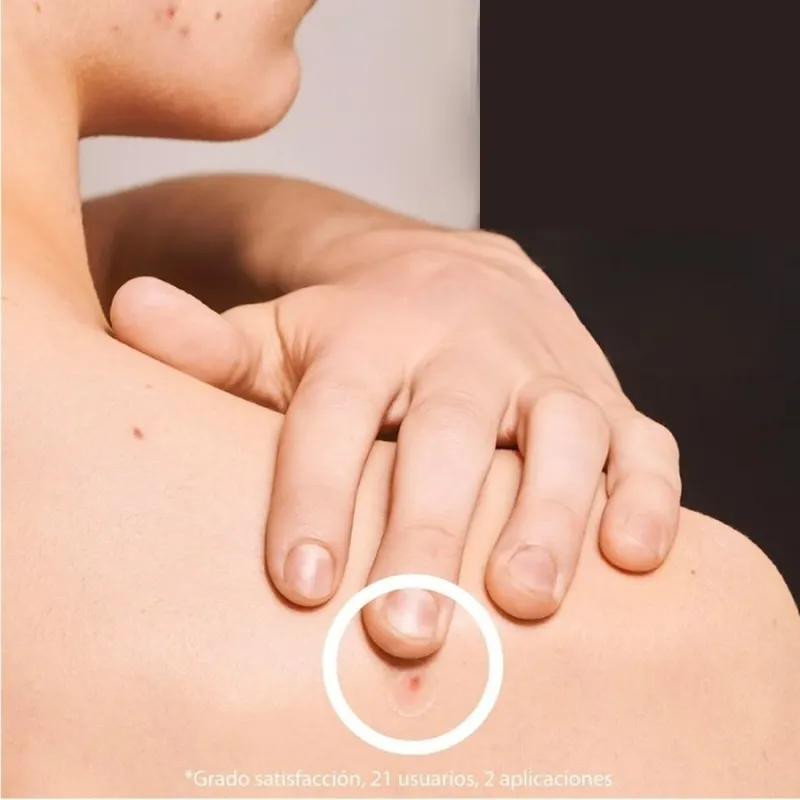 Iroha SOS Pimple Patches with Salicylic Acid — 3