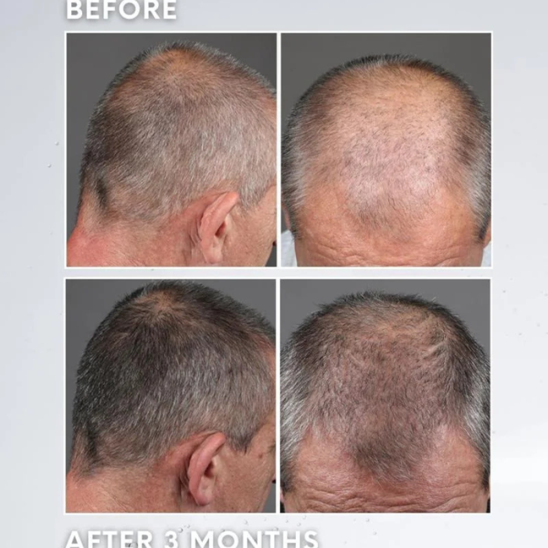 Лосион против побеляване или посивяване на косата Subrina Professional Care Scalp Anti-Greying Lotion 120 ml — снимка 4