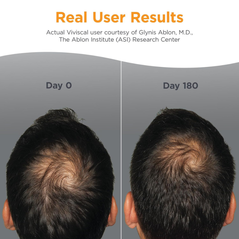 Viviscal Men Hair Growth Supplements 60 tabs — 3