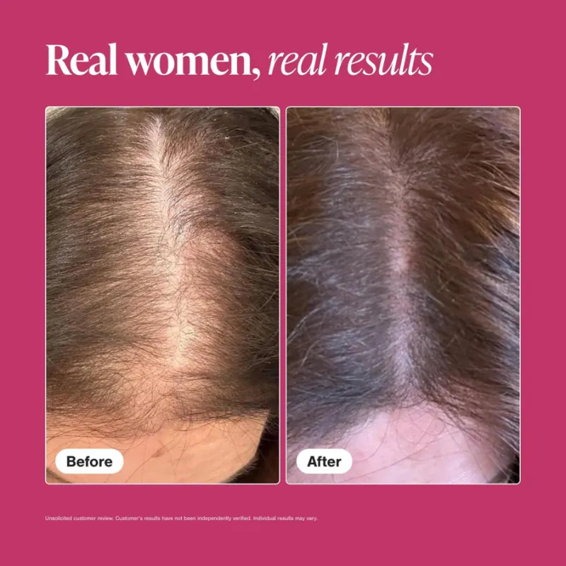 Viviscal 3-month hair loss and growth program for women — 2