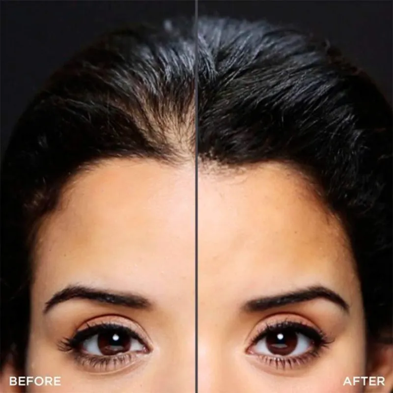 Toppik Hair Optimizer — 2