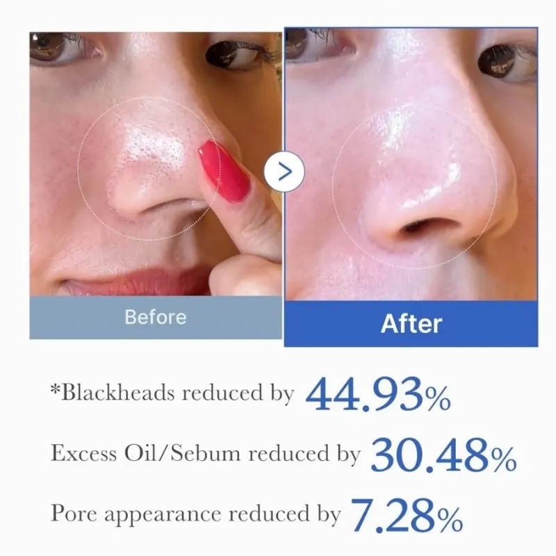 Medicube Zero Pore One Day Serum 30ml — 7
