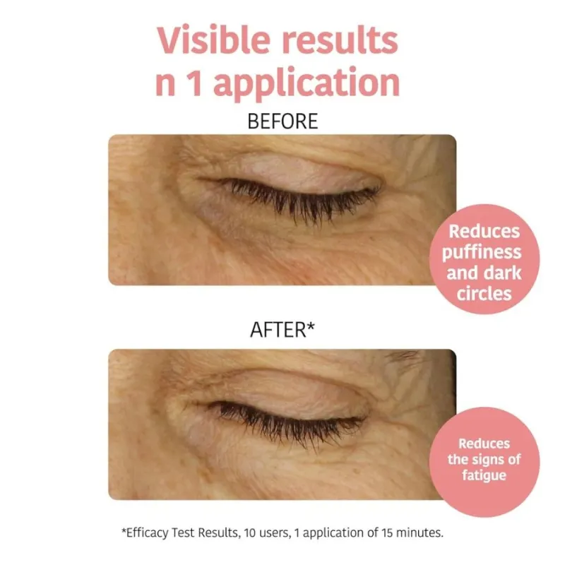 Iroha Anti-fatigue and Illuminating Eye Contour Patches with Vitamin C — 2