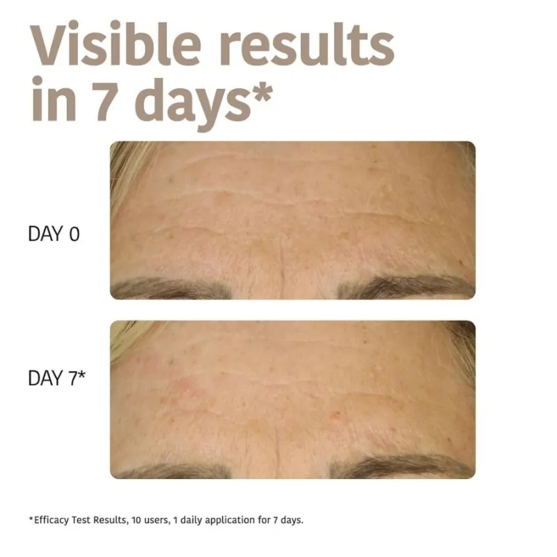 Iroha Firming & Anti-Age Sheet Mask with Bakuchiol — 4