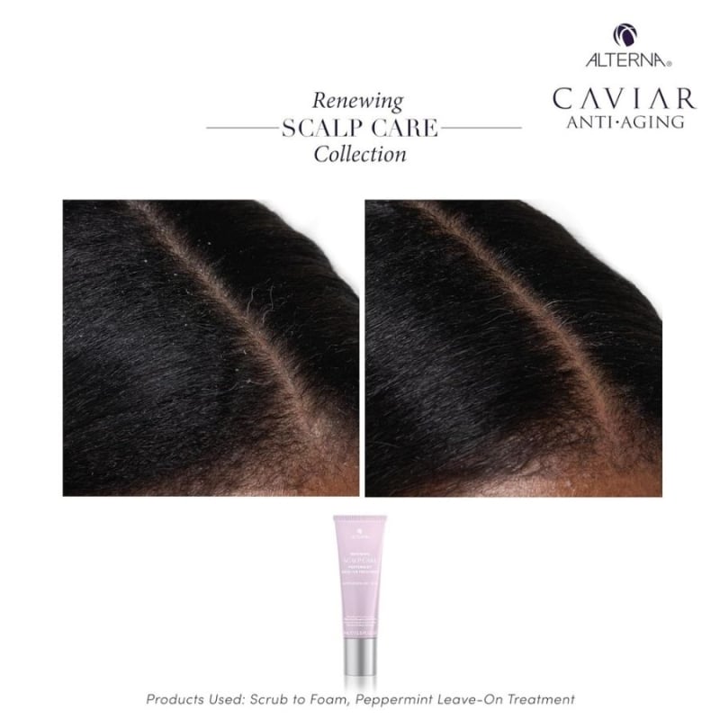 Ребалансираща терапия с мента за сух и проблемен скалп Alterna Renewing Scalp Care Peppermint Treatment 74 ml — изглед 4