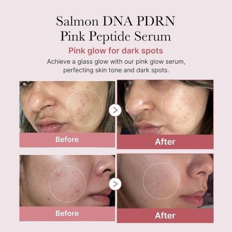 Серум за сияйна кожа и еластичност Medicube PDRN Pink Peptide Glow Serum 30 ml — изглед 3