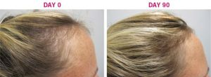 Хранителна добавка за растеж на коса при жени Viviscal Max Strength Hair Growth Supplements 180 таблетки