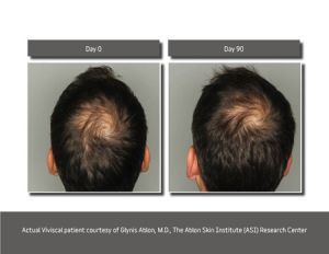 Хранителна добавка за растеж на коса при мъже Viviscal Men Hair Growth Supplements 60 таблетки